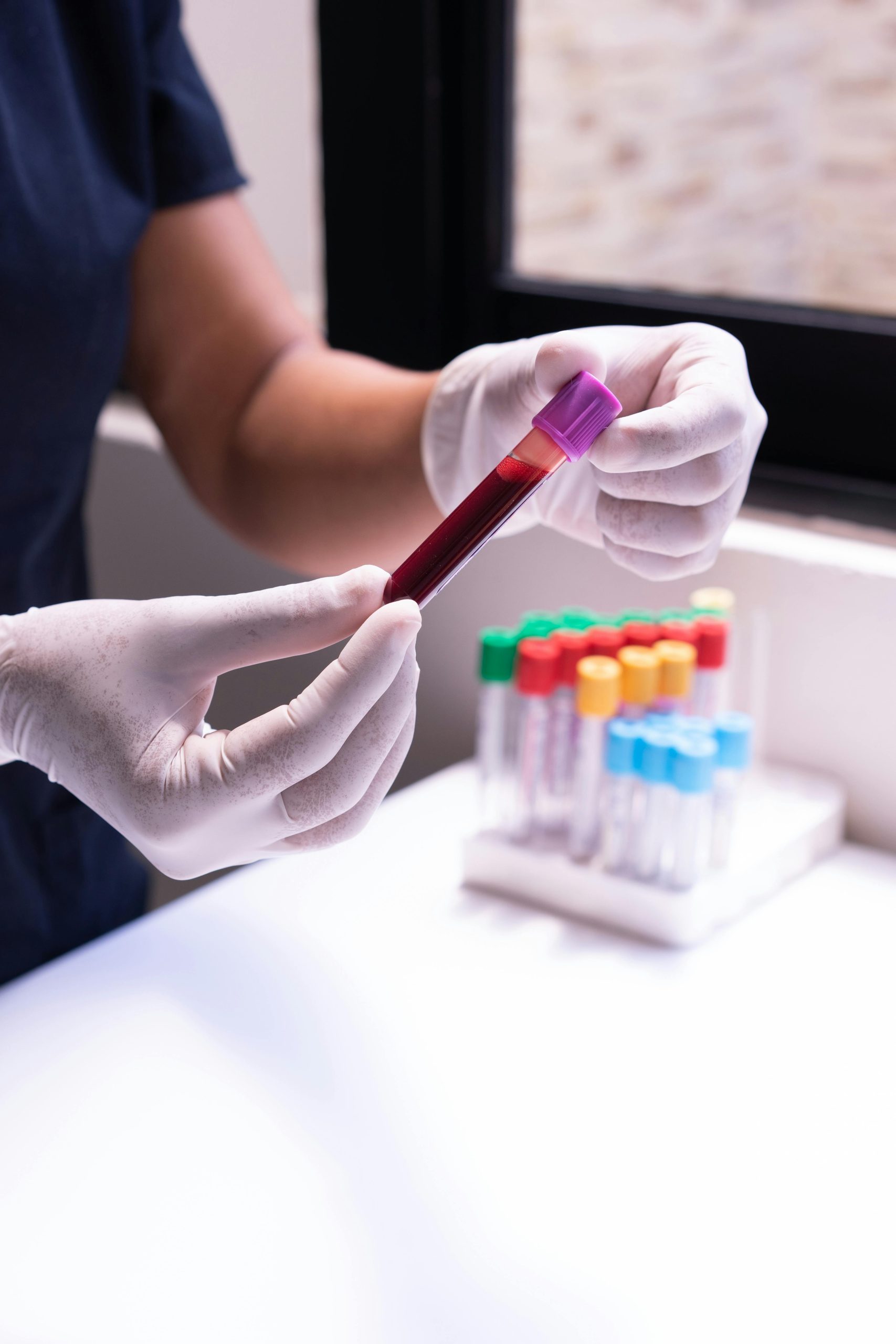 Dengue: Prevenção e diagnóstico rápido através de exames laboratoriais