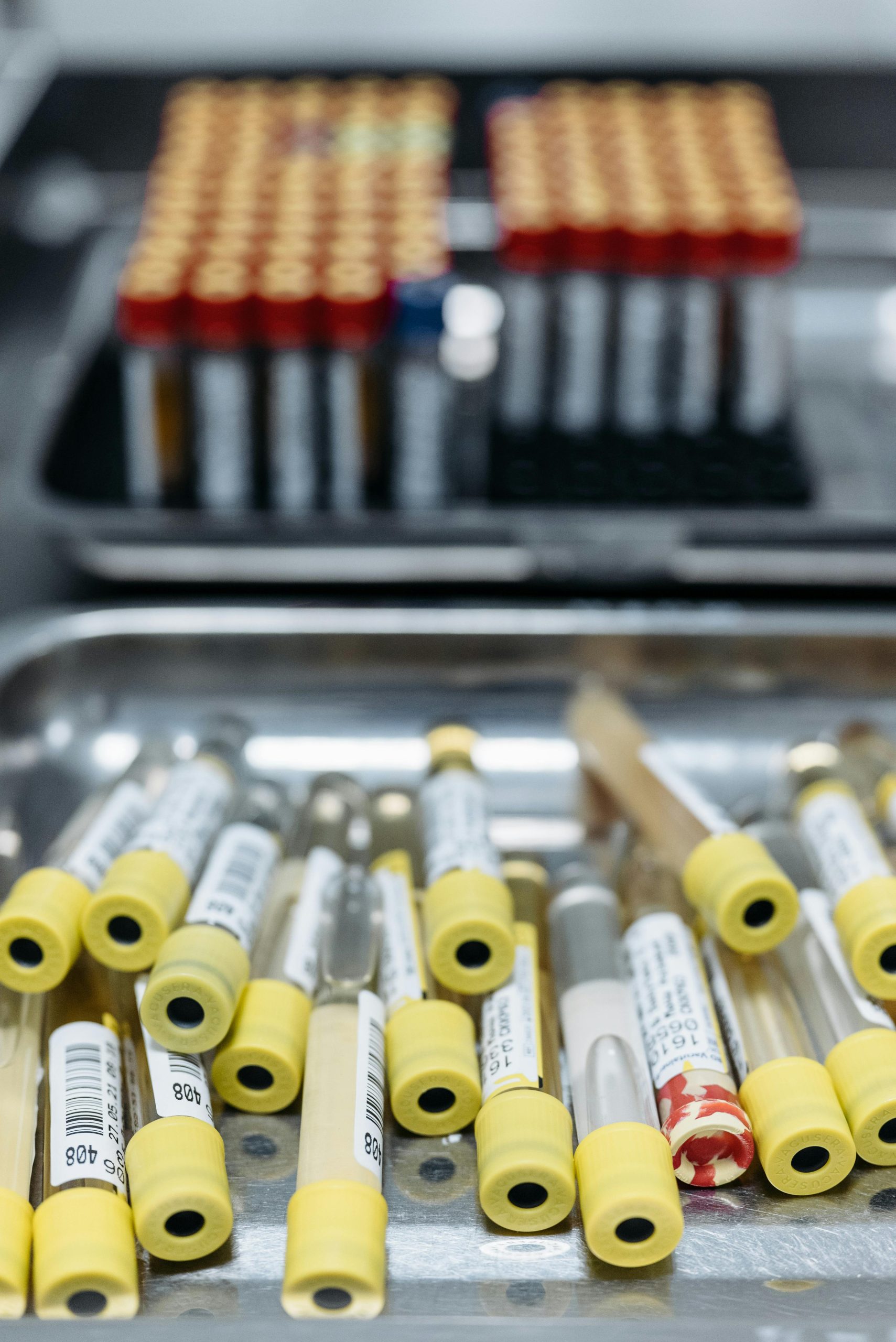 Exames Laboratoriais para Prevenção de Doenças: Dengue, COVID-19 e Influenza
