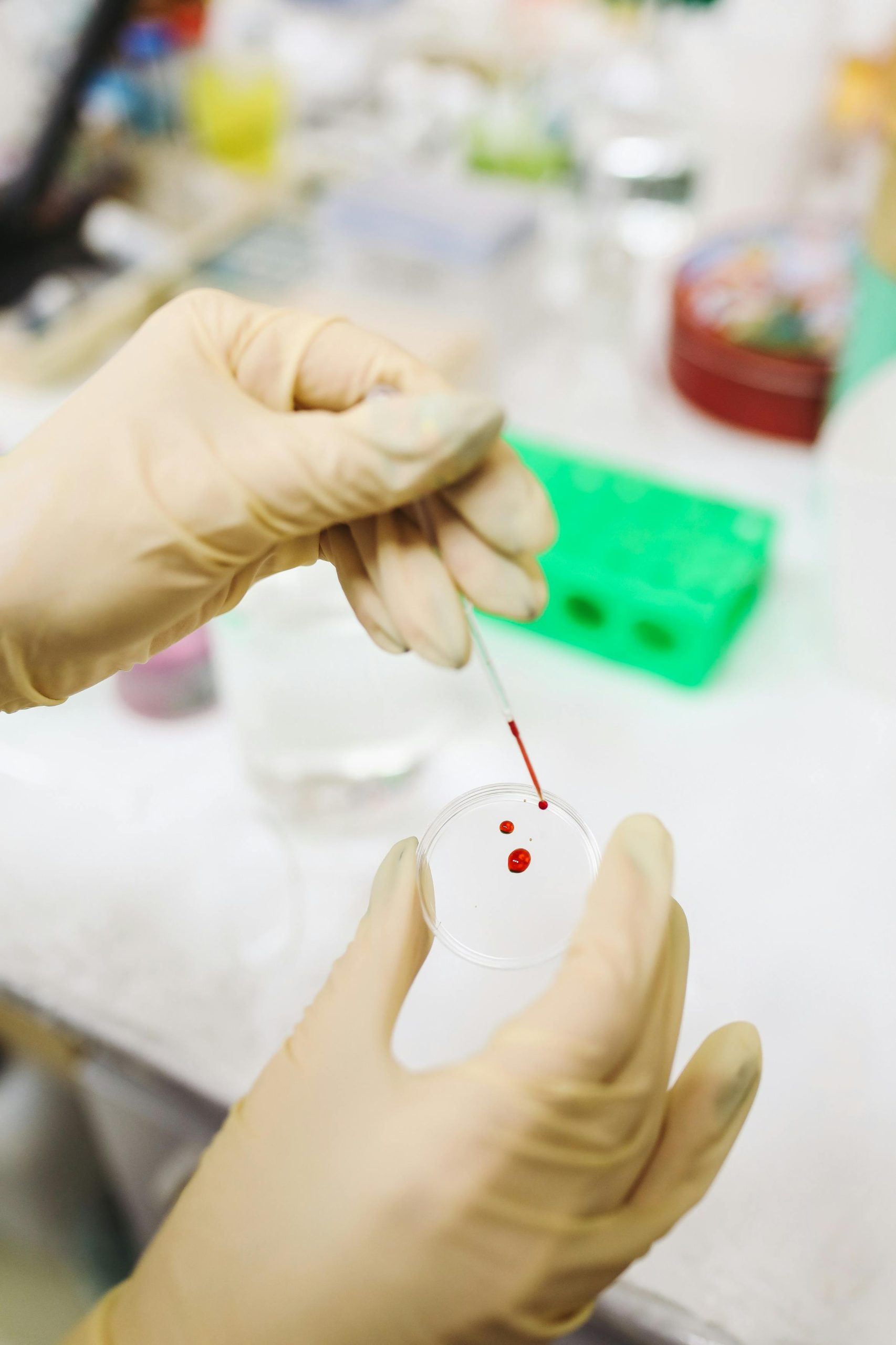 Como Identificar a Influenza com Exames Laboratoriais e Evitar Complicações